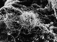 Рис. 3. Колония нанобов на поверхности песчаника, видимая в очень мощный электронный микроскоп