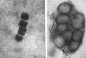 Клетки ископаемых прокариотных организмов, близких к цианобактериям